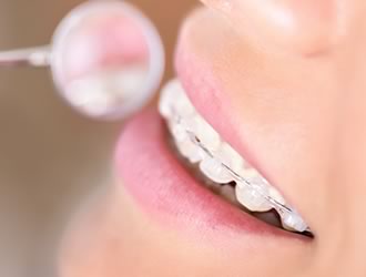 最近の「歯を短期間で動かすことのできる」矯正治療の注意点