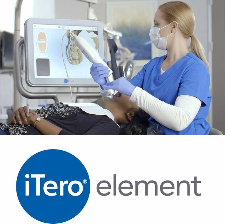 マウスピース型矯正歯科装置 iTero