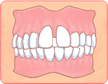 歯が並ぶスペースと歯の大きさの違い